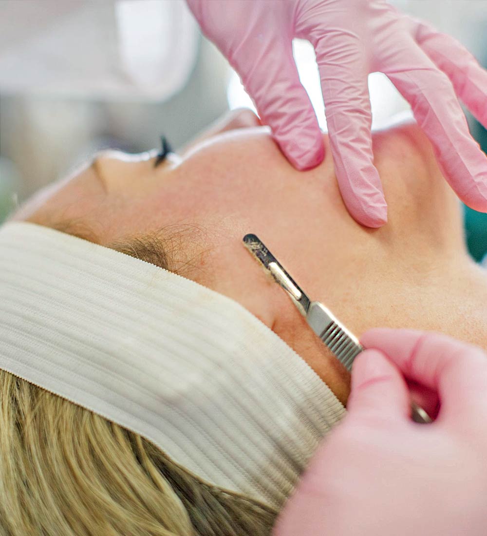 Dermaplaning by Cannock Aesthetics Hair and Beauty