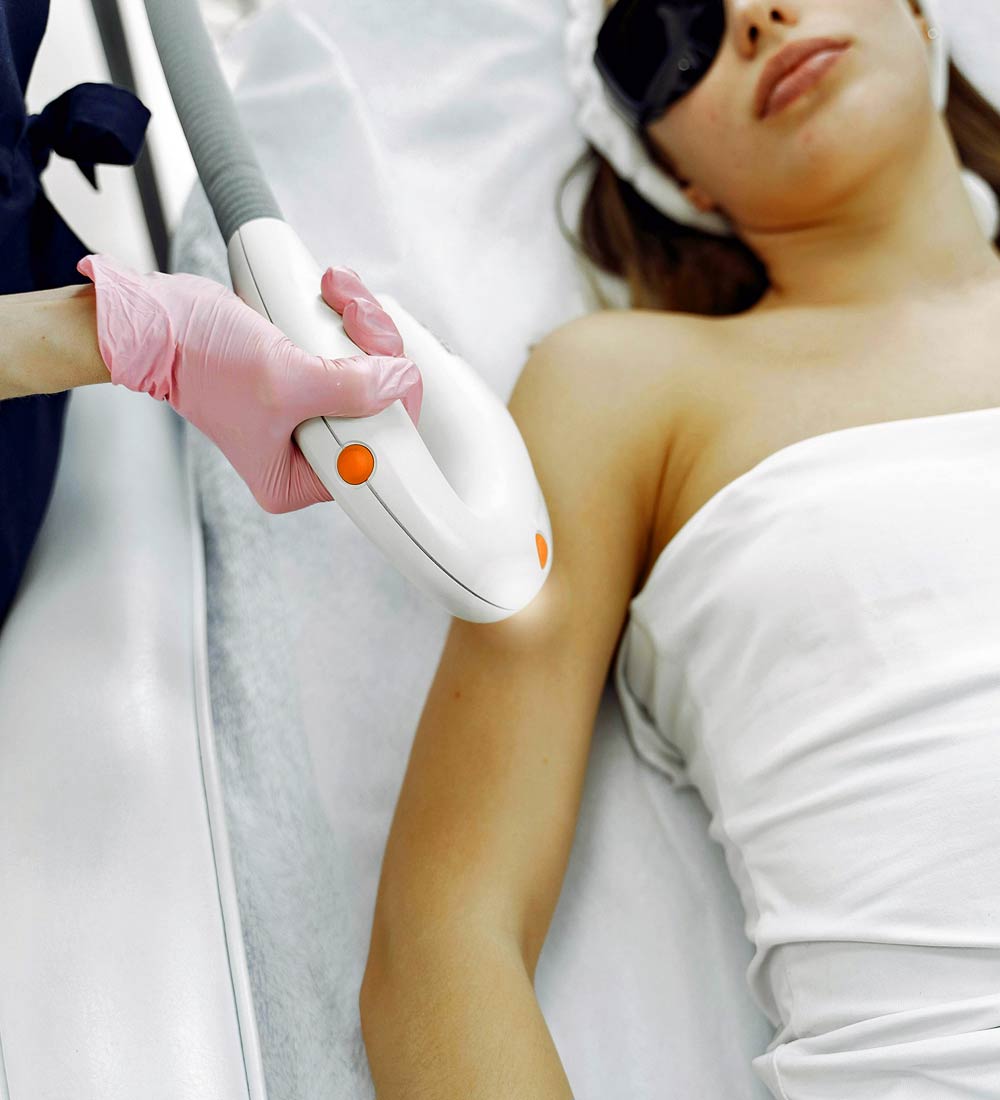 laser hair removal from Cannock Hair and Beauty
